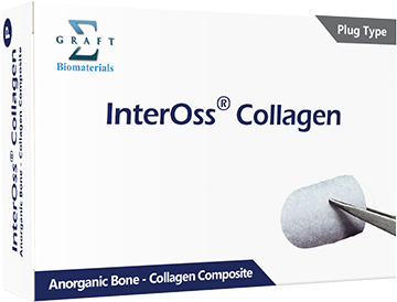 InterOss® 콜라겐 플러그